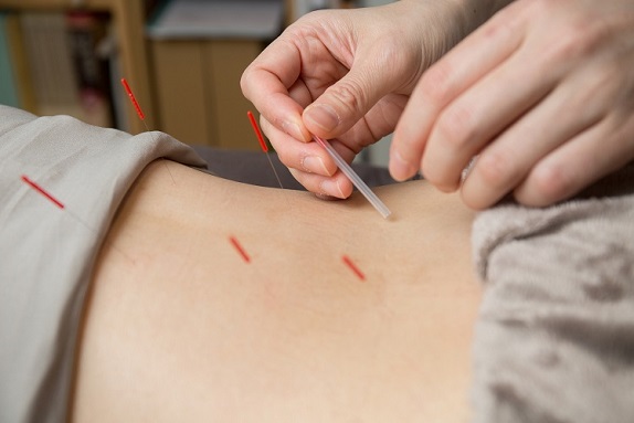 経絡治療